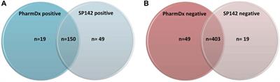 PD-L1 Testing in Urothelial Carcinoma: Analysis of a Series of 1401 Cases Using Both the 22C3 and SP142 Assays